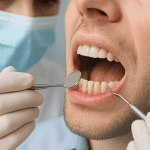 Cancerul pancreatic poate avea legatura cu lipsa igienei orale