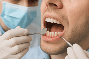 Cancerul pancreatic poate avea legatura cu lipsa igienei orale