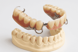 Proteza partiala scheletata