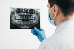 Radiografia dentara