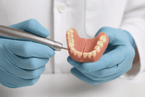 Reparatia protezei dentare